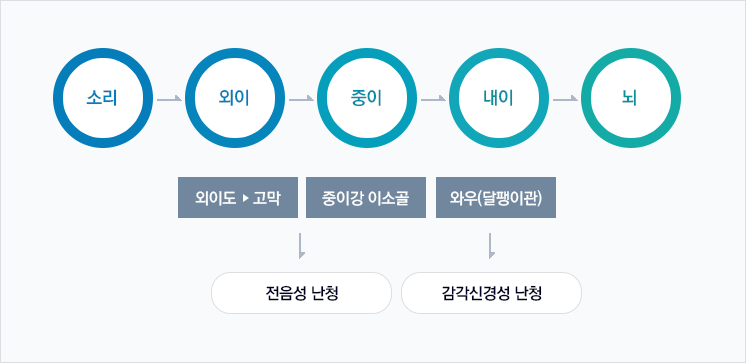 소리->외이->중이->내이->뇌, 외이->고막 과 중이 의 중이강 이소골의 이상이 전음성 난청, 내이의 와우(달팽이관)이상이 감음신경성 난청